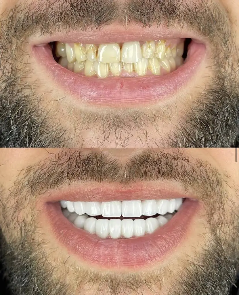 The Center for Advanced Dentistry