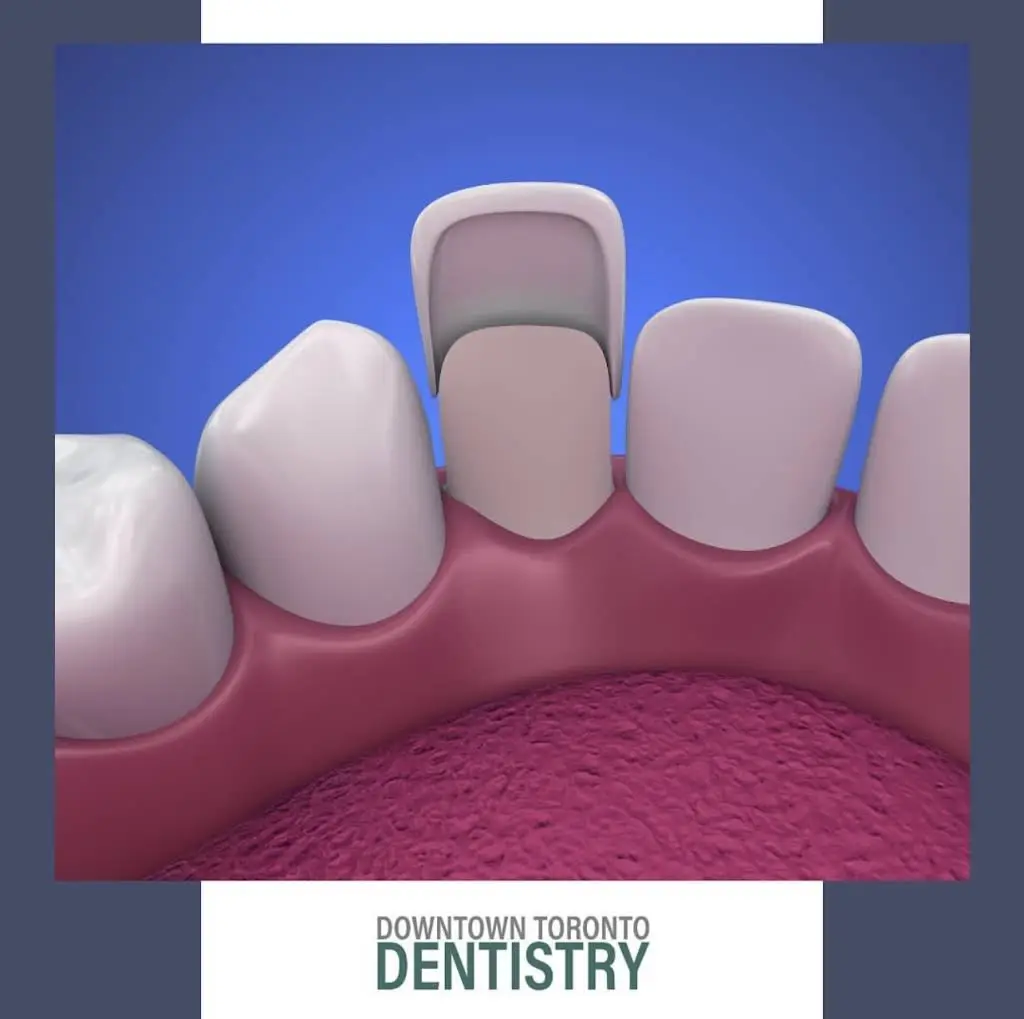 Downtown Toronto Dentistry