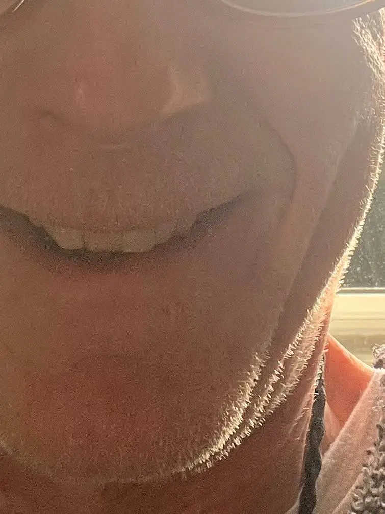 Beech Dental