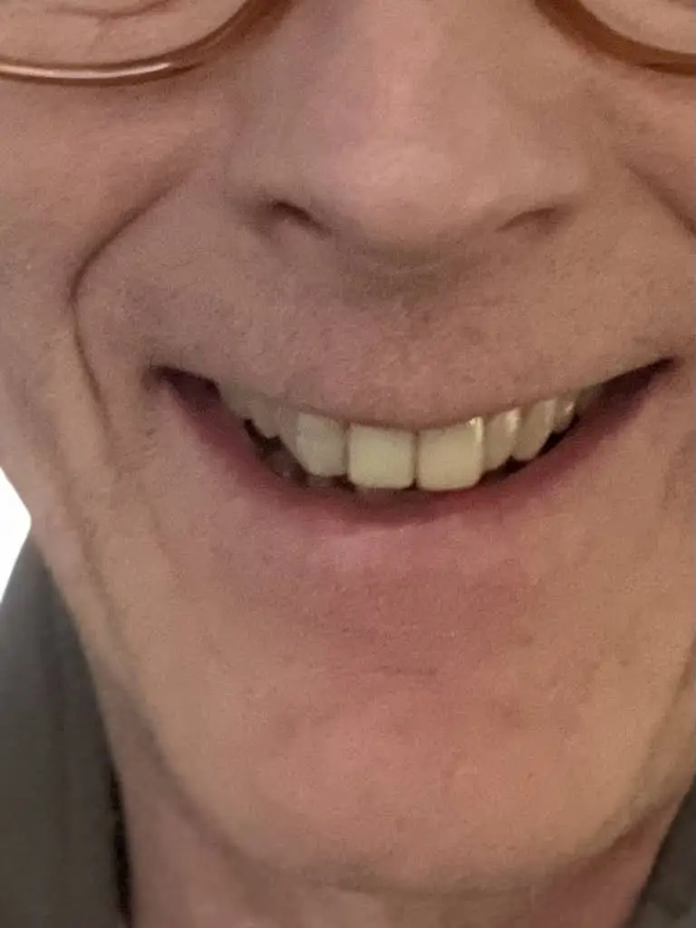 Beech Dental