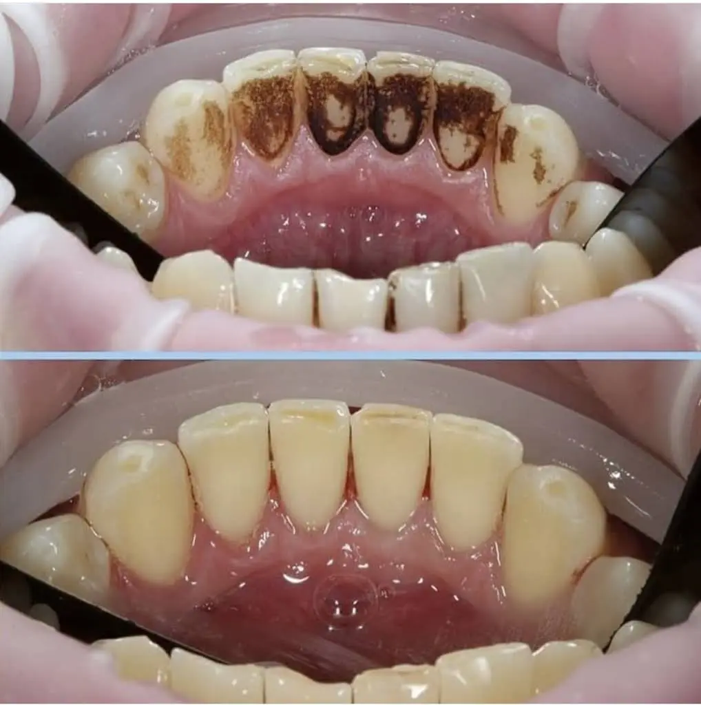 Birchcliff Dental