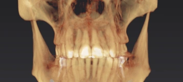 Lexington Endodontics