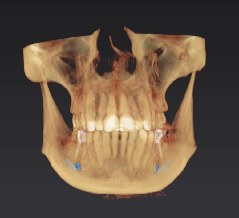 Lexington Endodontics