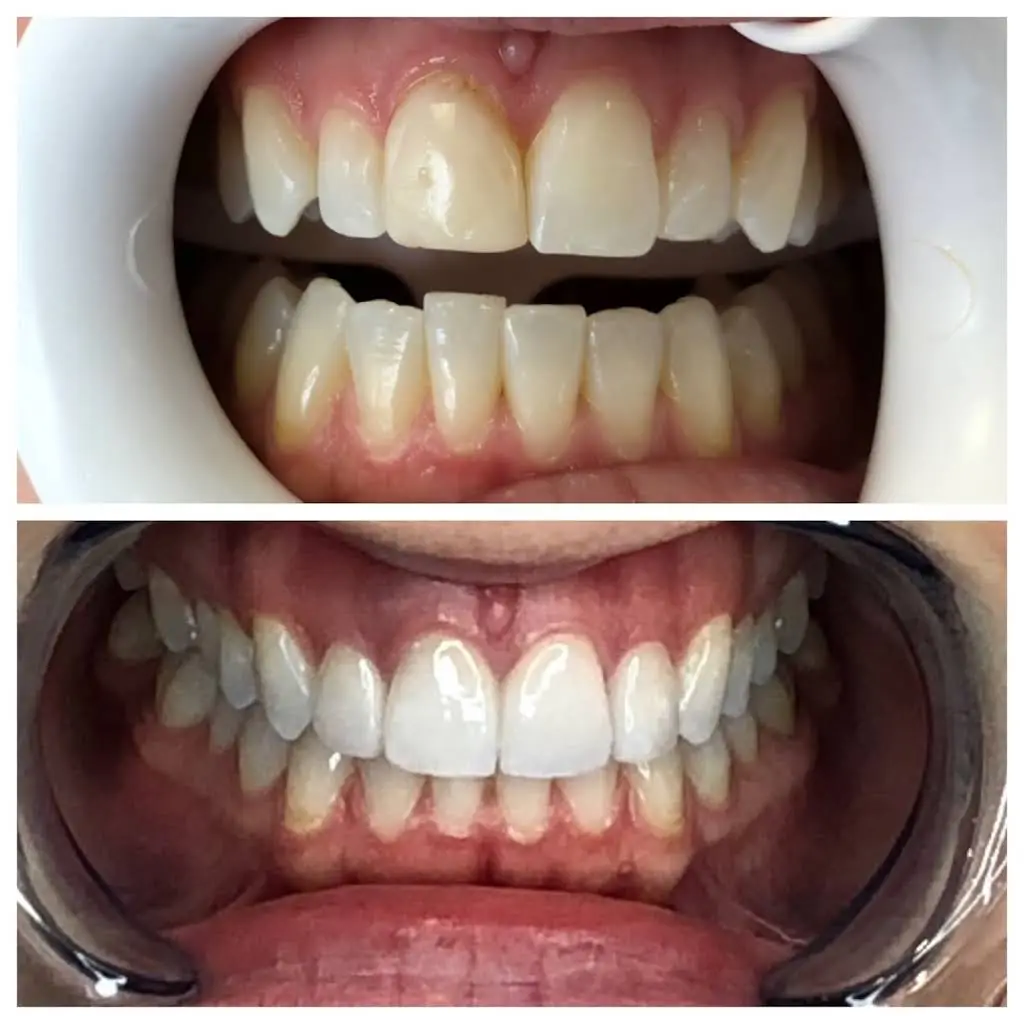 Schroeder Dentistry