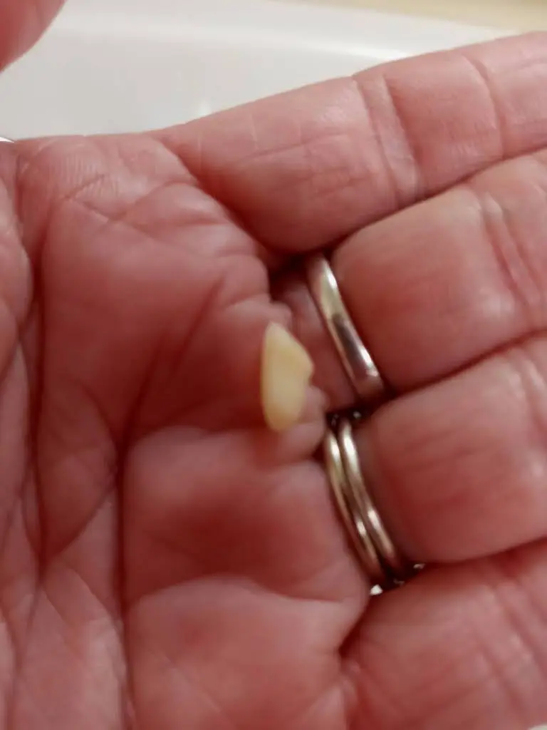 Shepherdsville Dental