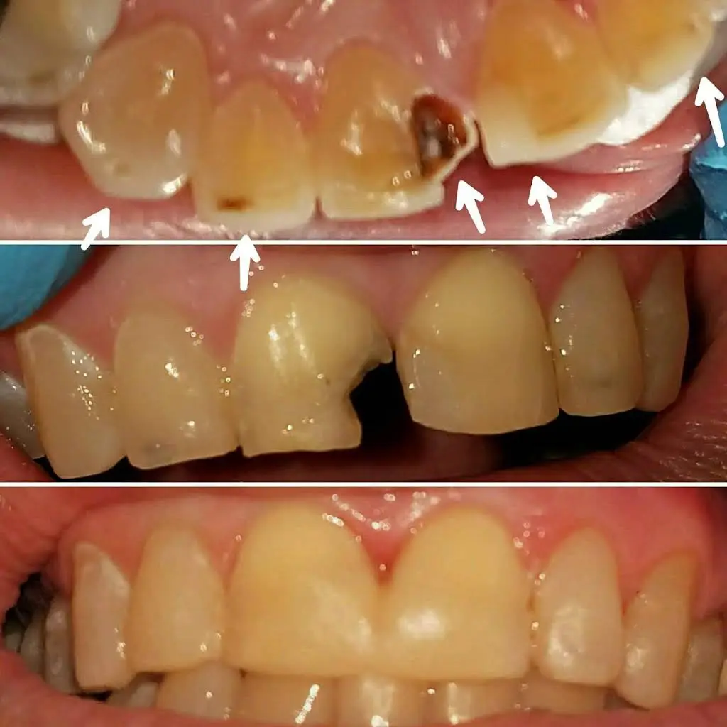 Bellefonte Family Dental Care PSC