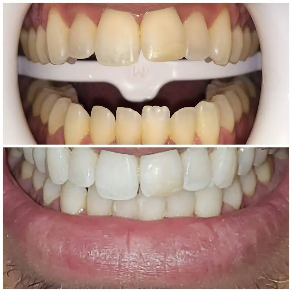 Bellefonte Family Dental Care PSC