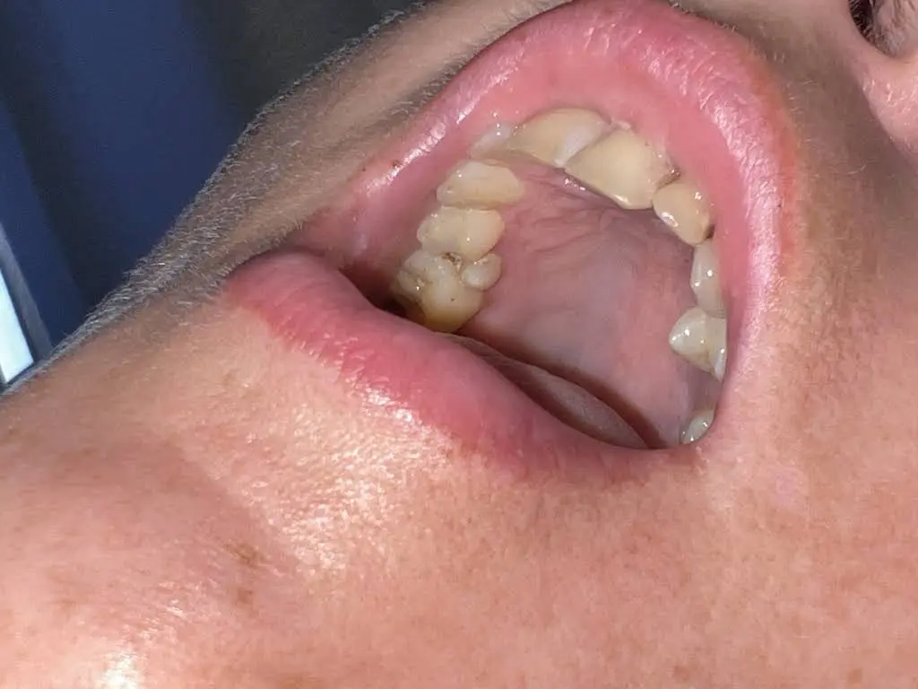 Ironton Denture Clinic