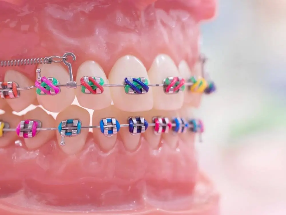 Lafayette Orthodontics - Dr. Burns & Dr. Hani