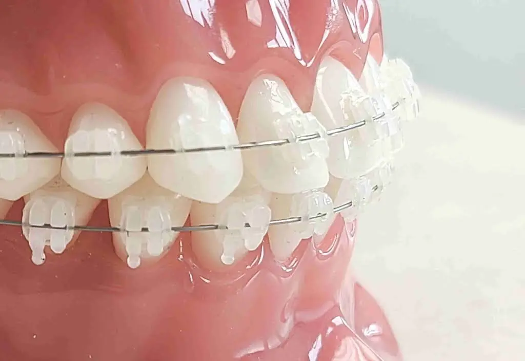 Lafayette Orthodontics - Dr. Burns & Dr. Hani