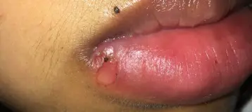 Oral Surgery Office