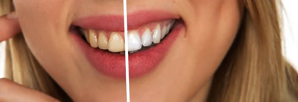 Impressions Dental