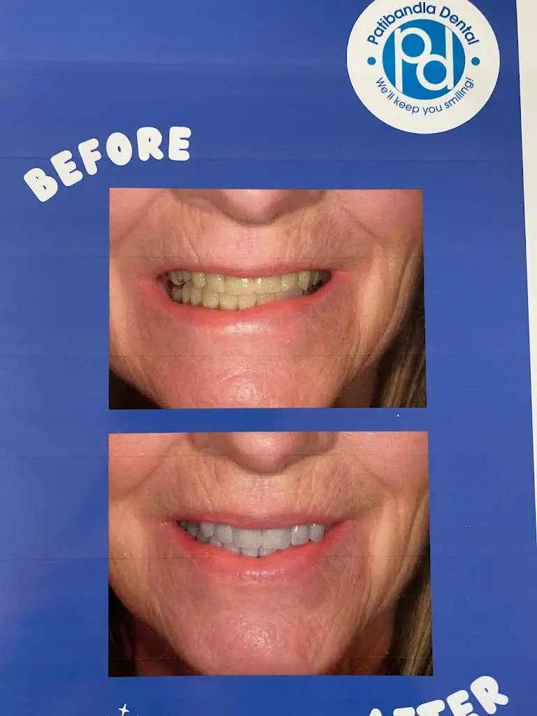 Patibandla Dental