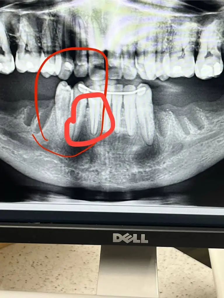 Aspen Dental