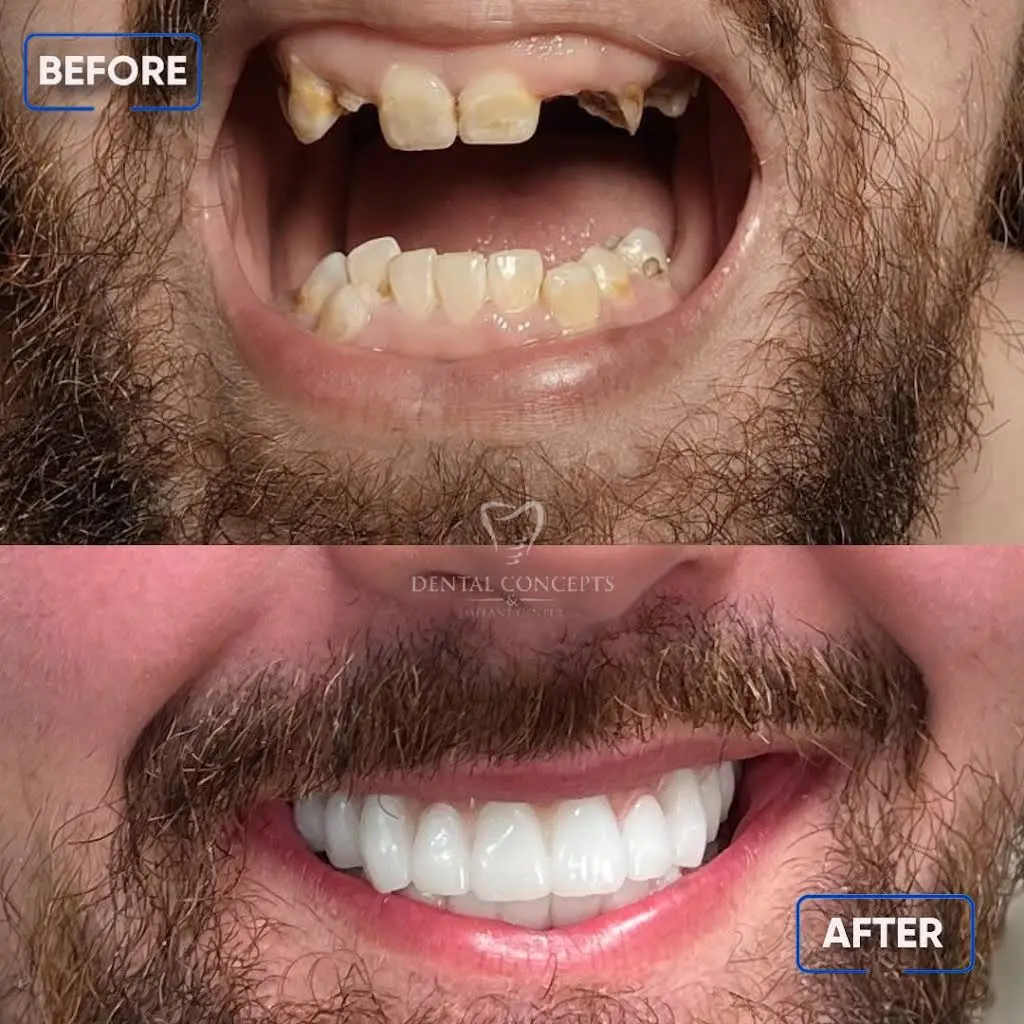 Dental Concepts and Implant Center