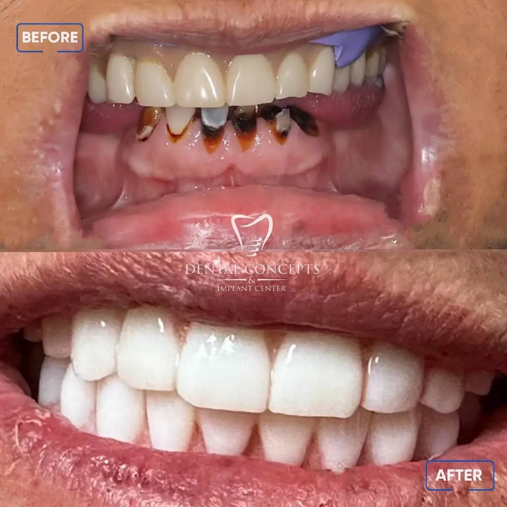 Dental Concepts and Implant Center