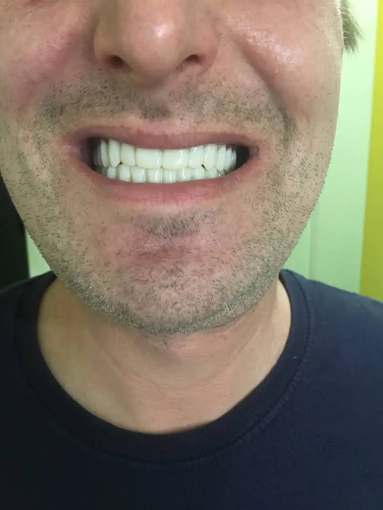 Aspen Dental