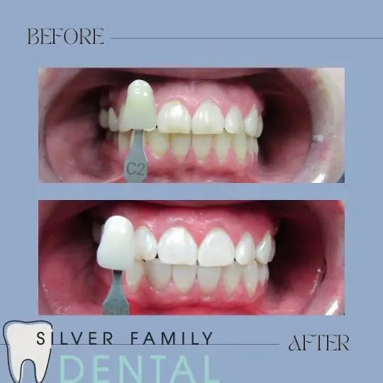 Silver Family Dental