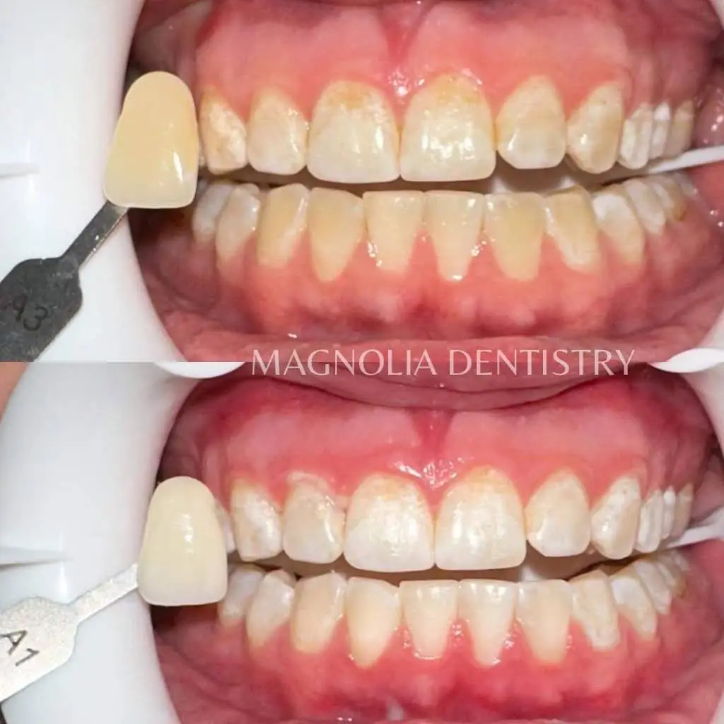 Magnolia Dentistry