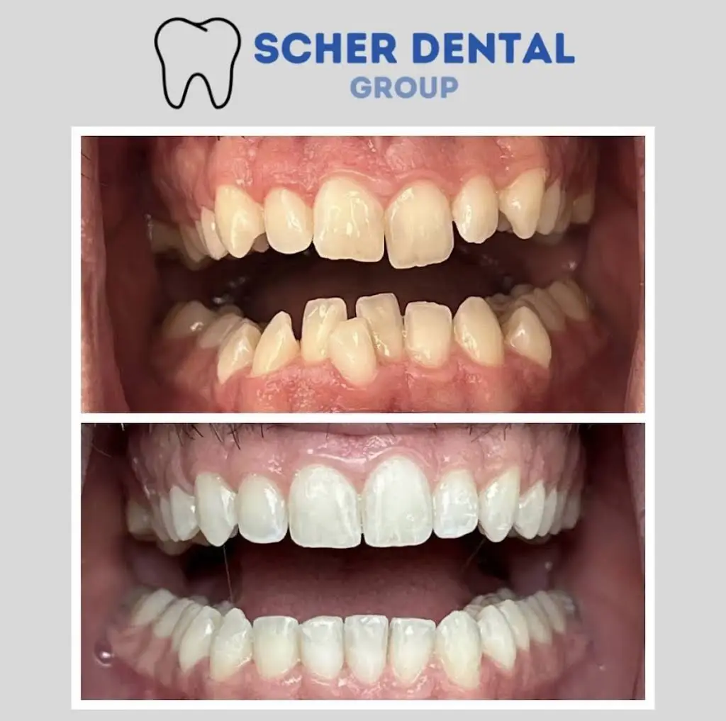Scher Dental Group