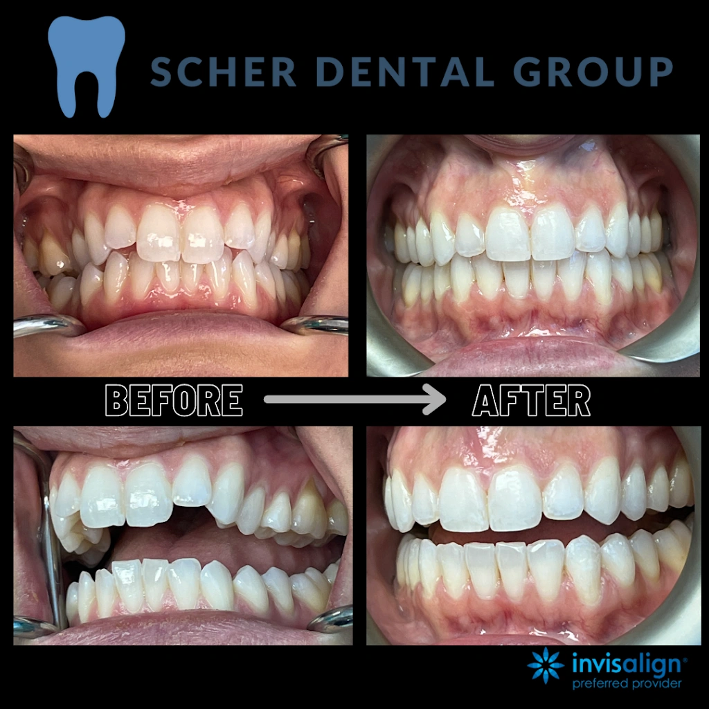 Scher Dental Group