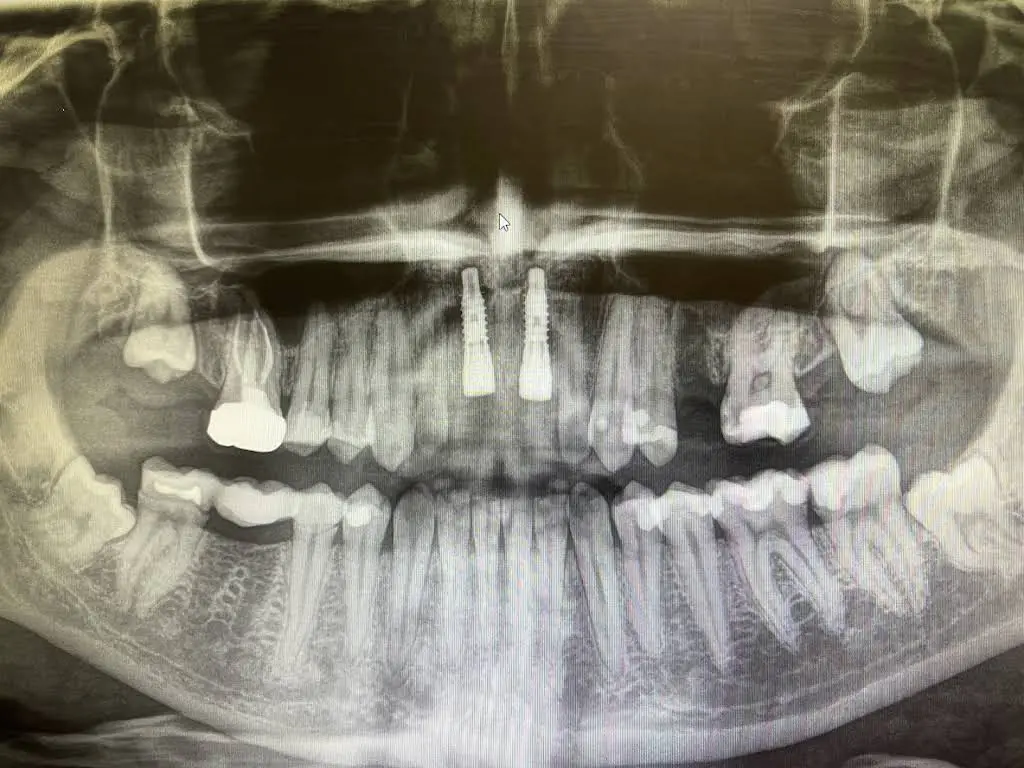 Center Street Dental