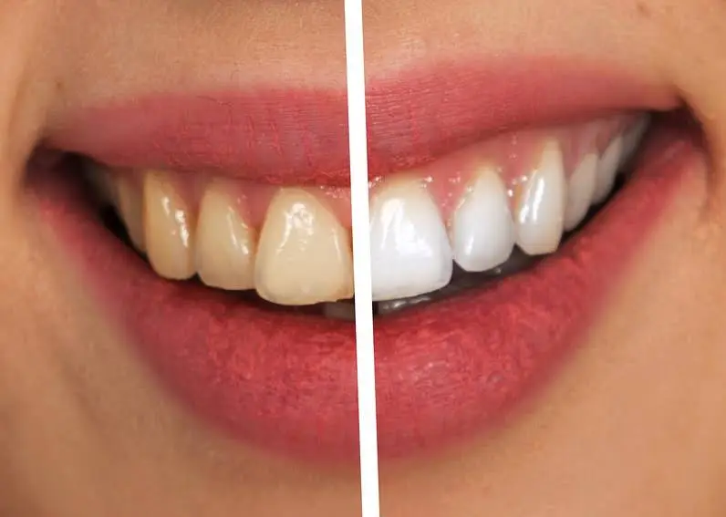 Fioritto Family Dental