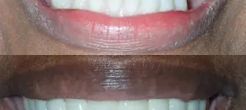 Singer Dental