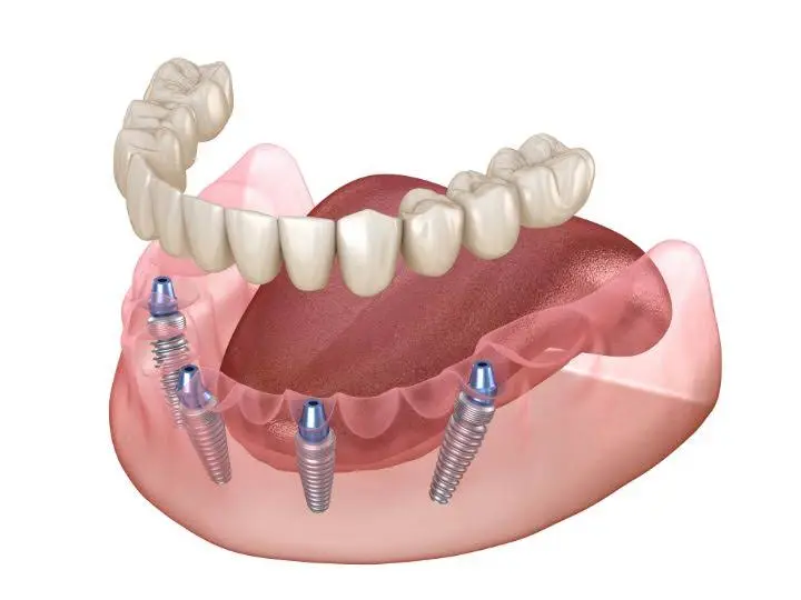 Singer Dental