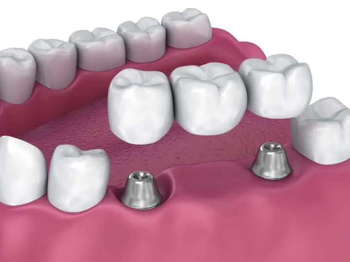 Singer Dental