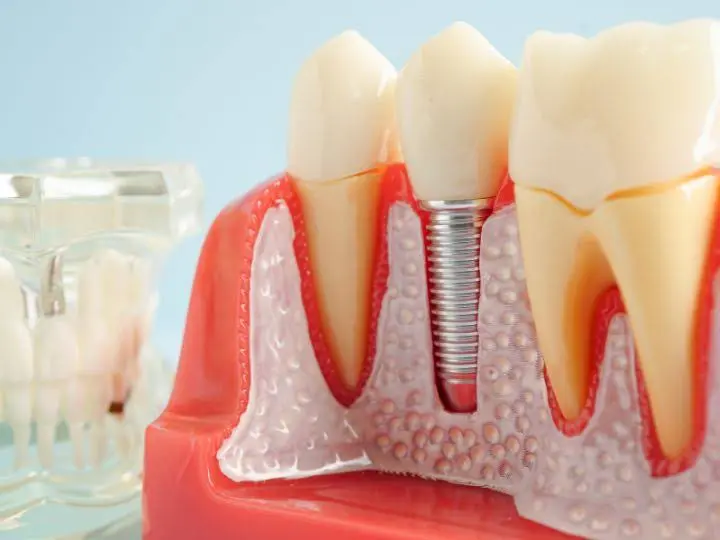 Singer Dental