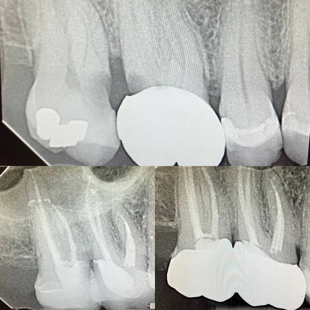 Singer Dental
