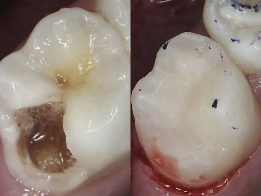 Dental Care for Kids