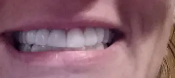 Marion Family Dentistry