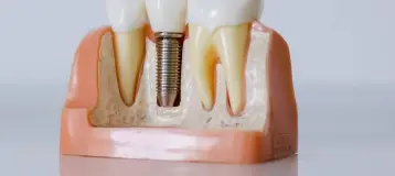 Richard Newhart, DDS