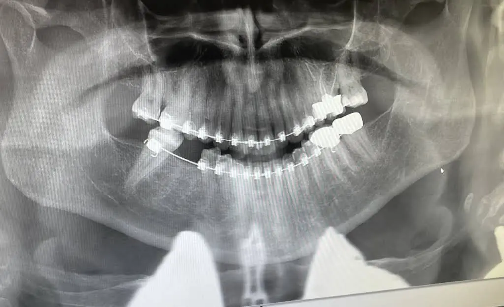 Dietrich Orthodontics