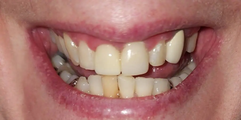 Complete Dental Care
