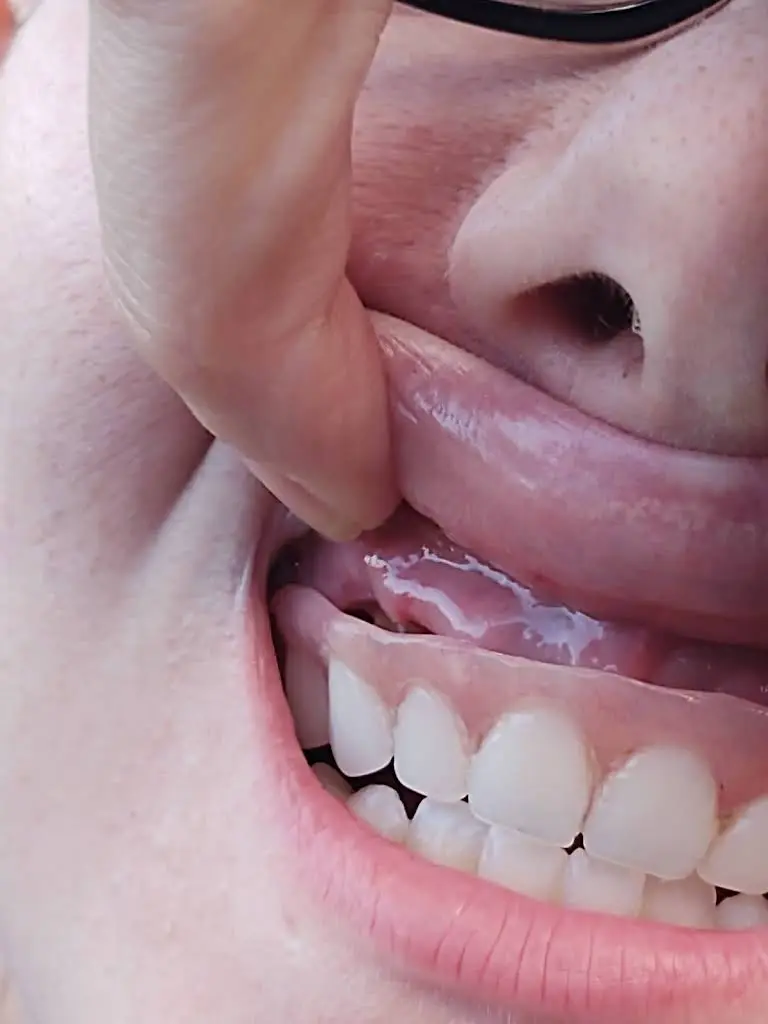 Complete Dental Care