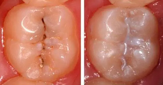 Richard Scherbauer DDS Inc
