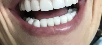 Neil Ross Dental Enhancements