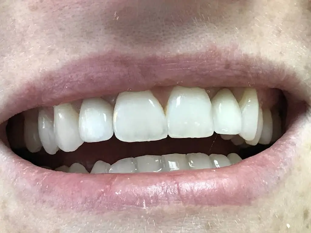 Neil Ross Dental Enhancements