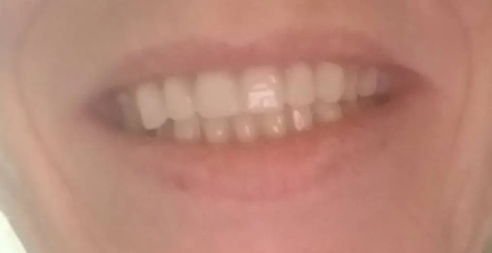 Accel Dental