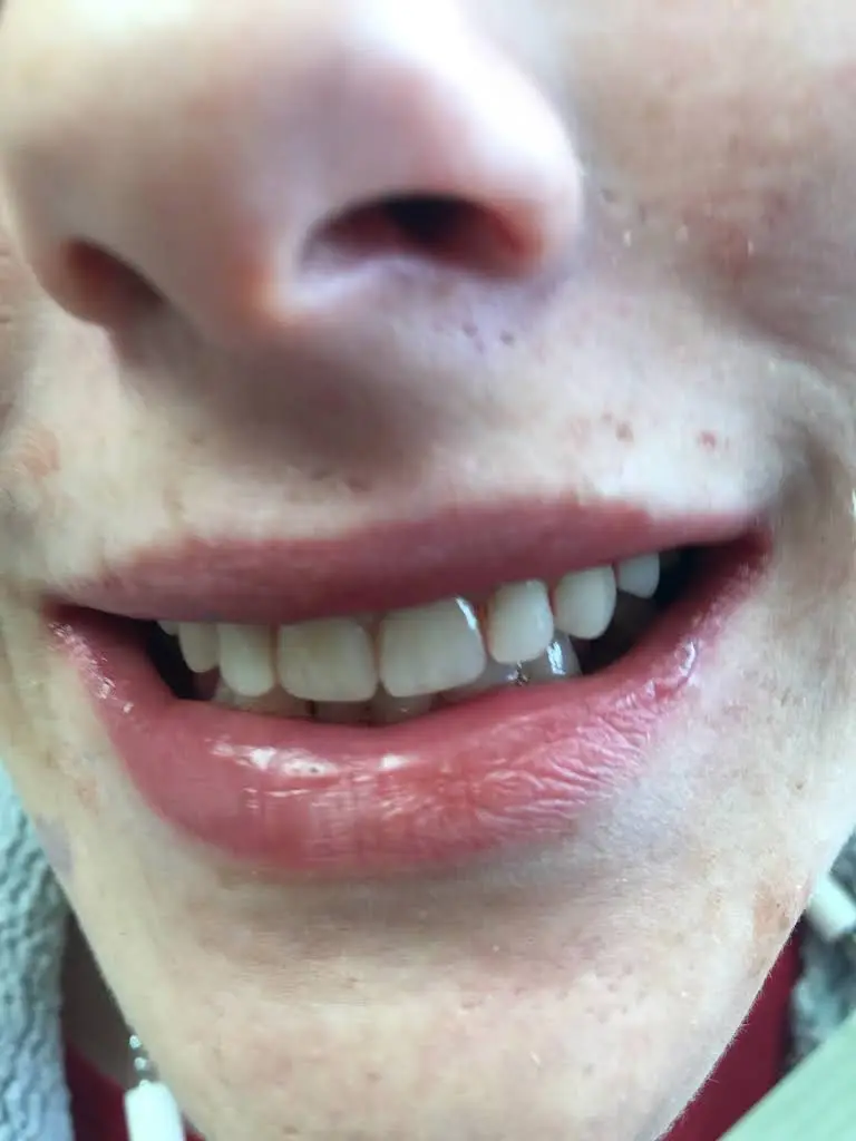 Just For Kids Dentistry