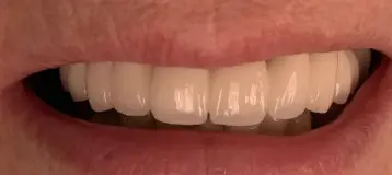Dura Dental Center