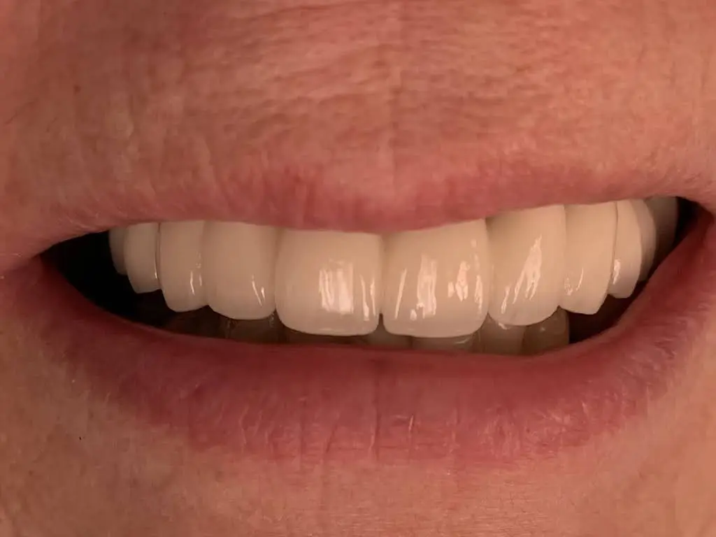 Dura Dental Center