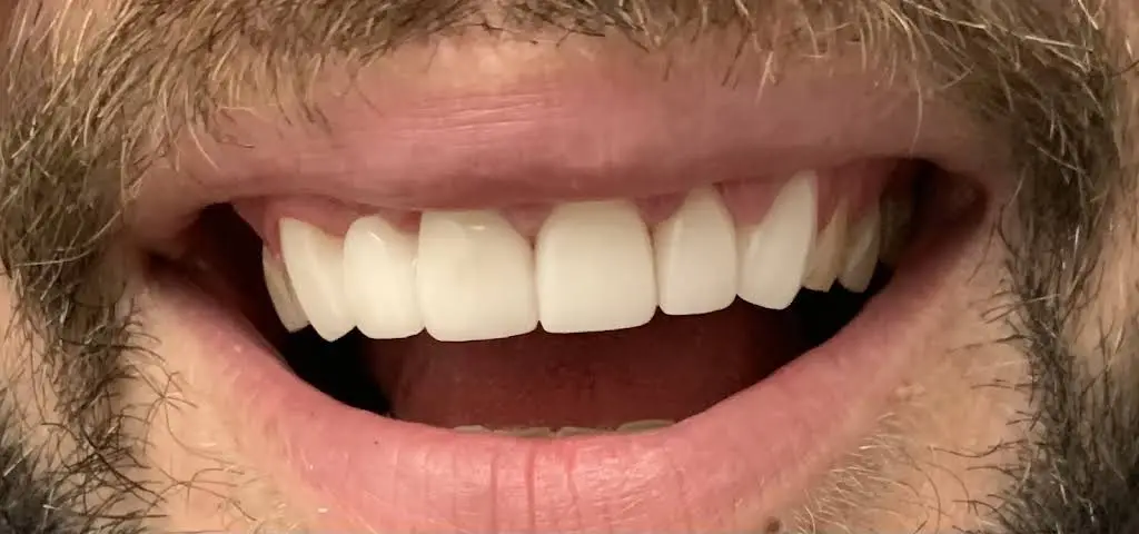 Dura Dental Center