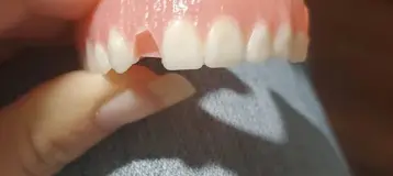 Aspen Dental