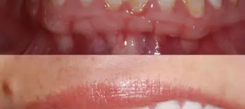 Family & Cosmetic Dentistry; Steve Childress II & Austin Willis