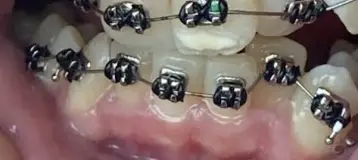 Crowe & Company Orthodontics