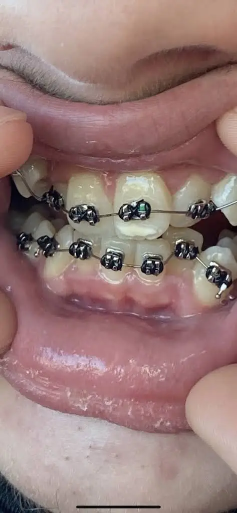 Crowe & Company Orthodontics